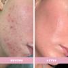 Doll 10 - Smooth Assist Overnight Facial 11% Triple-Acid Resurfacing Serum - Proven Overnight Transformation - Improves Skin Tone, Pores, Wrinkles & More - Vegan, Cruelty Free & No Parabens (1 oz) view 3