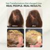 HairSmart Hair Growth Shampoo  Organic Shampoo with Ginger, Amla & Neem for Thicker, Healthier Hair (Shampoo.) view 4