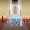 IPL Laser Hair Removal for Women - Painless Permanent Hair Removal, Sapphire with Ice Cooling Function, Facial Hair Removal for Women, Painless Hair Removal Device by PINKZIO view 2