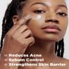 SKINRxLAB Made Cera Cream - Acne & Redness Relief Face Moisturizer, Sebum Control, Improving Skin Barrier with Ceramide and Madecassoside, Anti-Aging and Pore Minimizing Face Cream, 1.69 fl.oz. view 2