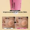 SKINRxLAB Made Cera Cream - Acne & Redness Relief Face Moisturizer, Sebum Control, Improving Skin Barrier with Ceramide and Madecassoside, Anti-Aging and Pore Minimizing Face Cream, 1.69 fl.oz. view 3