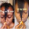 Hair oil view 1