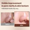 1.618 Volcanic Clay Korean Face Mask Fast-Drying Smooth Mud Mask with Tea Tree Care for Blackheads and Pores Pore Minimizer Skin Care Reducer view 3