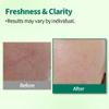 1.618 Korean Foam Face Wash - pH 6.5 Balanced Tea Tree Cleanser  Salicylic Acid & Plant-Based Formula for Blemish-Prone, Oily Skin | 5.07 oz view 3