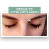 Park Perfection Lash Enhancing Serum - Promotes Appearance of Longer, Thicker Eyelashes, Dermatologist-Developed, Cruelty-Free, Grow Longer Eyelashes (3.5 mL) view 4