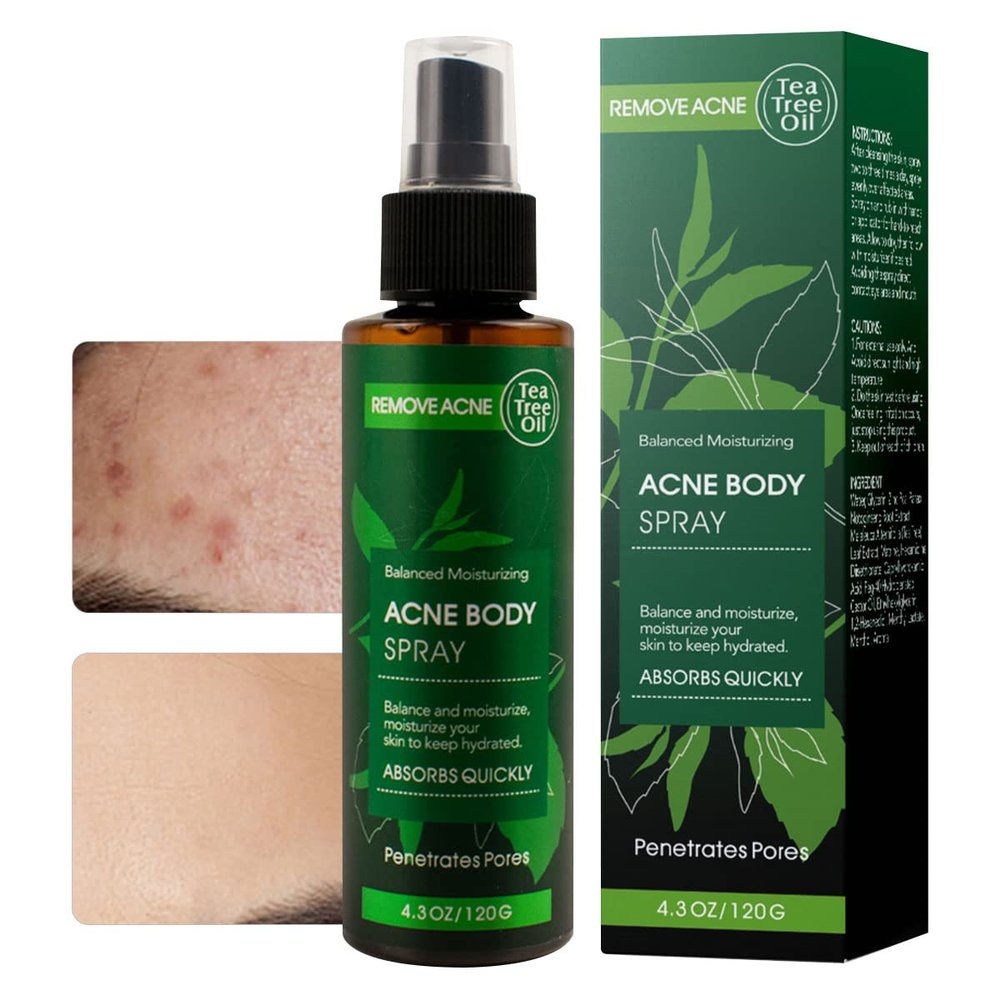 MOKYDUO Acne Spray with Natural Organic Tea Tree Oil - Body, Back, Chest & Face Acne Treatment, Fast Healing Acne Dots, Clears, Balances & Moisturizes All Skin Types - 4.3 OZ
