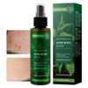 MOKYDUO Acne Spray with Natural Organic Tea Tree Oil - Body, Back, Chest & Face Acne Treatment, Fast Healing Acne Dots, Clears, Balances & Moisturizes All Skin Types - 4.3 OZ view 1