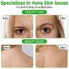 MOKYDUO Acne Spray with Natural Organic Tea Tree Oil - Body, Back, Chest & Face Acne Treatment, Fast Healing Acne Dots, Clears, Balances & Moisturizes All Skin Types - 4.3 OZ view 3
