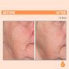 Serious Skincare - Serious-C3 Plasma Vitamin C Restore - Restoration Night Cream for Deep Hydration - Hydrolyzed Collagen - Hydrating Moisture for Face and Neck - 1.7 oz. view 3