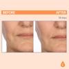 Serious Skincare - Serious-C3 Plasma Vitamin C Restore - Restoration Night Cream for Deep Hydration - Hydrolyzed Collagen - Hydrating Moisture for Face and Neck - 1.7 oz. view 4