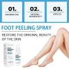 Callus Remover Spray, Foot Peeling Exfoliating Spray, Foot Care Cream, Lotus Biquan Moisturizing Foot Spray, Effectively Improve Dry, Rough, Cracked Foot Skin, Especially in the Dry Season, 1.7 fl Oz view 3