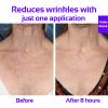 Skywee Professional Products Chest Wrinkle Pads Upgraded - Decollete Anti Cleavage Wrinkles Silicone Pad Set of 3 Reusable Patches for Skin Lines Prevention, Wrinkle Remover Treatment view 4