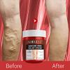 AUQUEST 80g Feet Varicose Veins Cream Treatment Relieve Dilated Capillaries Removal Phlebitis Spider Leg Veins Varicose Cream view 2