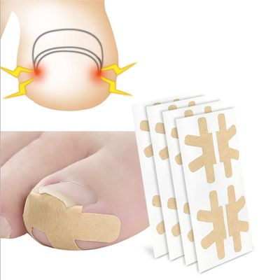 Ingrown Toenail Correction Stickers, 16 Pcs Ingrown Toenail Correction Patches Thick Paronychia Corrector Stickers, Toe Nail Healing Care Patch Professional Ingrown Toenail Pedicure Tool