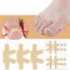 Ingrown Toenail Correction Stickers, 16 Pcs Ingrown Toenail Correction Patches Thick Paronychia Corrector Stickers, Toe Nail Healing Care Patch Professional Ingrown Toenail Pedicure Tool view 4
