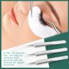Blackhead Remover Tools, 16 PCS Pimple Popper Tool Kit, Acne Blackhead Tools for Blemish, 410 Premium Professional Stainless Acne Pimple Extractor Tool with Metal Box view 3