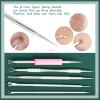 Blackhead Remover Tools, 16 PCS Pimple Popper Tool Kit, Acne Blackhead Tools for Blemish, 410 Premium Professional Stainless Acne Pimple Extractor Tool with Metal Box view 4