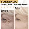 High Frequency Tongue Glass Tube Replacement for TUMAKOU view 3