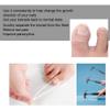 2pcs Silicone Ingrown Toenail Correcting Tool, Pain Relief Paronychia Treatment Corrector Professional Paronychia Corrector Physical Treatment Recover view 4