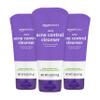 Amazon Basics Acne Cleanser Face Wash - Daily Control, Maximum Strength 10% Benzoyl Peroxide, 5 Ounce (Pack of 3) view 1