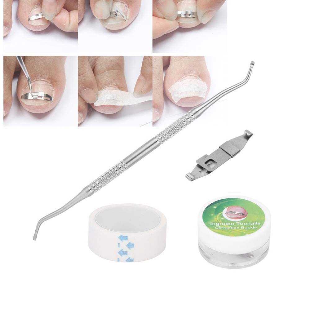 3pcs Ingrown Toenail Removal Kit, Professional Stainless Steel Ingrown Toenail Tool, Stretchable Designs Paronychia Treatment Nail Correction Buckle Adhesive Tape Set for Foot Care