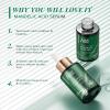 ANAI RUI Mandelic Acid 10% Serum 1.05FL.Oz view 3