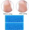 40 Pcs Pumice Stone for Feet Foot Scrubber Sponge for Feet Care and Callus Remover Mini Disposable Pumice Pads for Dead Skin Remover (Blue) view 2