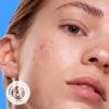 AVARELLE Triple Patch Kits Hydrocolloid Acne Patches, Acne Spot Treatment for Blemishes and Zit with Tea Tree Oil, Calendula Oil and Cica Oil for Face, Vegan, Cruelty Free(40 CT + Support) view 4