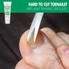 Toenail Softener for Thick Hard Toenails - Safe for Seniors & All Ages - Fast-Acting Toenail Softening Cream - Ingrown Toenail Treatment - Non Greasy Nail Cream Formulated with Natural Aloe Vera, 1 oz view 2