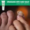 Toenail Softener for Thick Hard Toenails - Safe for Seniors & All Ages - Fast-Acting Toenail Softening Cream - Ingrown Toenail Treatment - Non Greasy Nail Cream Formulated with Natural Aloe Vera, 1 oz view 4