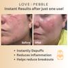 Love & Pebble Beauty Pops - Ice Roller Massage & Skin Care Ice Mask for Face Set with Turmeric & Aloe | Cryo Dermal Benefits of Ice Face Roller and Gua Sha, As Seen on Shark Tank and Tik Tok view 4