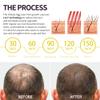 Instyle Egg 280 Cap for Hair Regrowth, Low Level Laser Therapy System for Hair Loss and Regrow Thinning Hair for Men/Women view 3