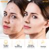 MYSWEETY High F Rrequncy Portable Handheld Facial Skin Care Wand Machine view 4