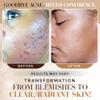 Noir D'or Acne Scar Treatment, Hyperpigmentation Treatment for Face, Normal to Oily Acne Skincare | Three Step Scar Repair Set for Acne Scars and Dark Spot Remover | Breakout Acne Treatment for Scars view 4