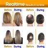 Ammuri Biotin Hair Growth Shampoo & Conditioner - DHT Blocker, Anti-Dandruff, Hair Loss & Hair Thickening Shampoo for Oily Hair - Promotes Hair Growth view 3