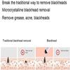 Dongng Blackhead Pore Vacuum Electric Blackhead Suction Tool USB Rechargeable with 3 Adjustable Suction Power and 3 Probes Blackhead Extractor Ideal Gift view 3