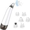 Dongng Blackhead Remover Pore Vacuum Facial Cleaner Electric Acne Extractor USB Rechargeable Comedo Removal Beauty Device with 6 Suction Head 3 Adjustable Suction Level Portable (White) view 2