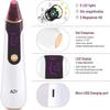 Dongng Electric Blackhead Vacuum Cleaner Pore Cleaner, 4-Head Heating Magnifies The Skin to Visualize Blackhead Pores and Heat Dissipation, to Remove Blackheads and Acn Portable view 2