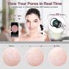 Dongng Electric Blackhead Vacuum Cleaner Pore Cleaner, 4-Head Heating Magnifies The Skin to Visualize Blackhead Pores and Heat Dissipation, to Remove Blackheads and Acn Portable view 4
