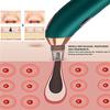 Dongng Comedone Extractor,Pore Cleaner,Facial Pores Cleaner,USB Rechargeable 5 Suction Modes 5 Probes Vacuum Blackhead Remover Tool Kit with Heat Funtion Black Head Remover (Green) view 3
