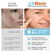 LitBear Large Acne Pimple Patches, 5 Sizes 80 Patches for Large Breakouts, Acne Patches for Face, Chin or Body, Acne Spot Patch with Tea Tree & Calendula Oil, Hydrocolloid Bandages for Acne Skin view 3