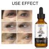 Caffeine Eye Serum, Eye Serum Anti Aging Wrinkles Effectively Fades Dark Circles, Eye Bags, Helping to Minimize Wrinkles and Fine Lines, Eliminate Puffiness, with EGCG, Vitamin C Under Eye Serum 30ml view 4