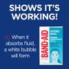 Band-Aid Brand Hydro Seal Acne Patches for Face, Non-Medicated Acne Blemish Patch Absorbs Fluids & Provides a Protective Healing Environment for Pimples, 7 Patches view 3