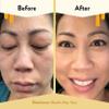 ECZEMA HONEY Soothing Facial Cream - Eczema Lotion for Face, Eyelids, Lips, and More - Natural Dry Skin Repair (2 Oz) view 4