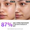 The INKEY List 15% Vitamin C and EGF Serum 1 Fl Oz, Reduces Hyperpigmentation, Rejuvenating Skin Care, Vegan Friendly, Suitable For All Skin Types view 2