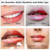 Silicone Lip Scrub Brush - Double-Sided Exfoliating Tool for Dark and Chapped Lips, Cleaner for Smoother and Fuller Appearance4PC view 2