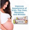 AZAZ Afflatus Ayurvedic Clear & Cure Anti Acne & Scar Removal Cream || Anti Pigmentation, Anti Blemish || Effective on Burn, Stretch & Post Pregnancy Marks- 30gm (Pack of 3) view 4