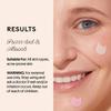 Winky Lux Catne Hydrocolloid Pimple Patches  36 Invisible Cat Shaped Acne Dots, Hydrocolloid Protects Blemishes, Treats Pimples & Calms Redness view 4