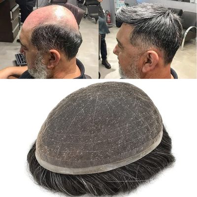 Toupee for Men French Lace Hairpiece Real Human Hair Replacement System Natural Hairline Mens Toupee Hair Prosthesis for Men (8"*10", 365# 3# Dark Brown+65% Grey-100% Light to Medium Density)