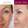 Beauty Solutions Retinol Cream Duo - Set of 2 Day & Night Anti-Aging Treatment Jars, 2.25 oz. Each White 30g per jar view 3